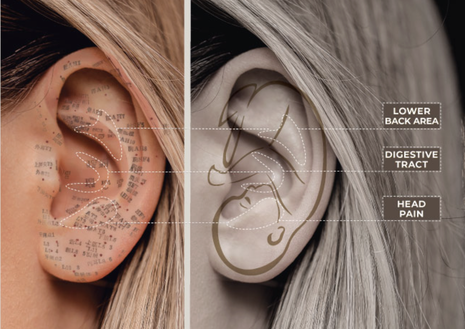 Ear Seeds TCM Auriculotherapy